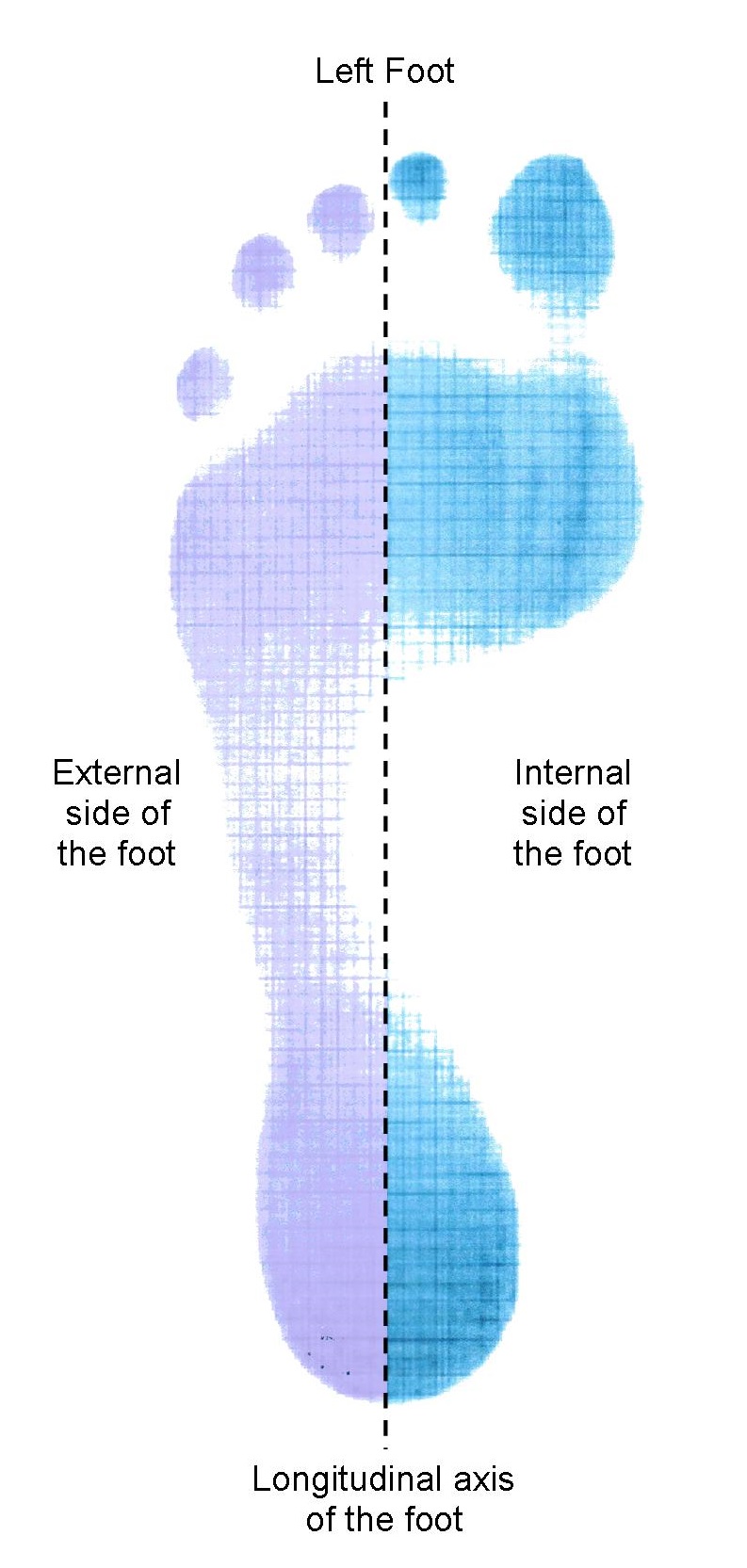 Pathologies Pronation of the foot